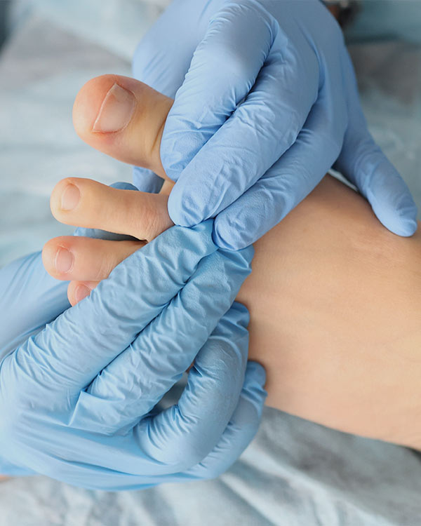 Laser Fungal Nail Treatment Near Me in Orange, CA Laser Fungal Nail Treatment Near Me in Orange, CA